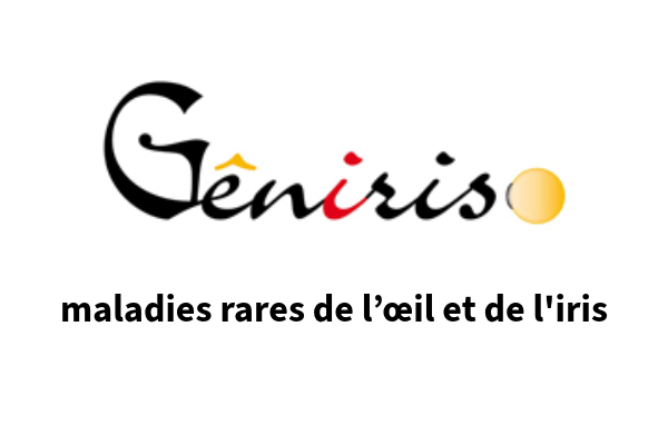 Gêniris Maladie rares de l'oeil et de l'iris